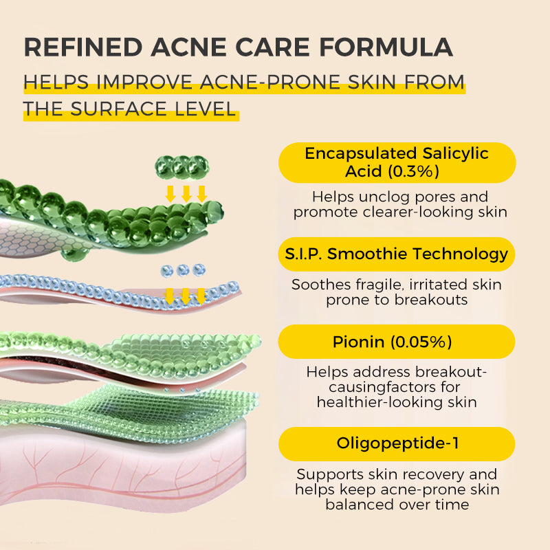 CKA Anti-Acne Refreshing Essence Mask