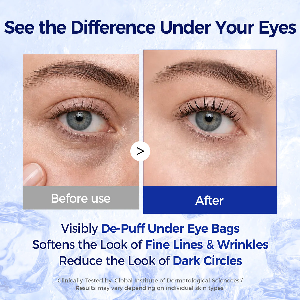 CKA Anti-Aging Collagen Freeze-Dried Essence Eye Mask