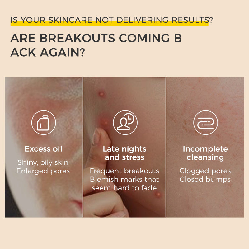 CKA Anti-Acne Refreshing Essence Mask